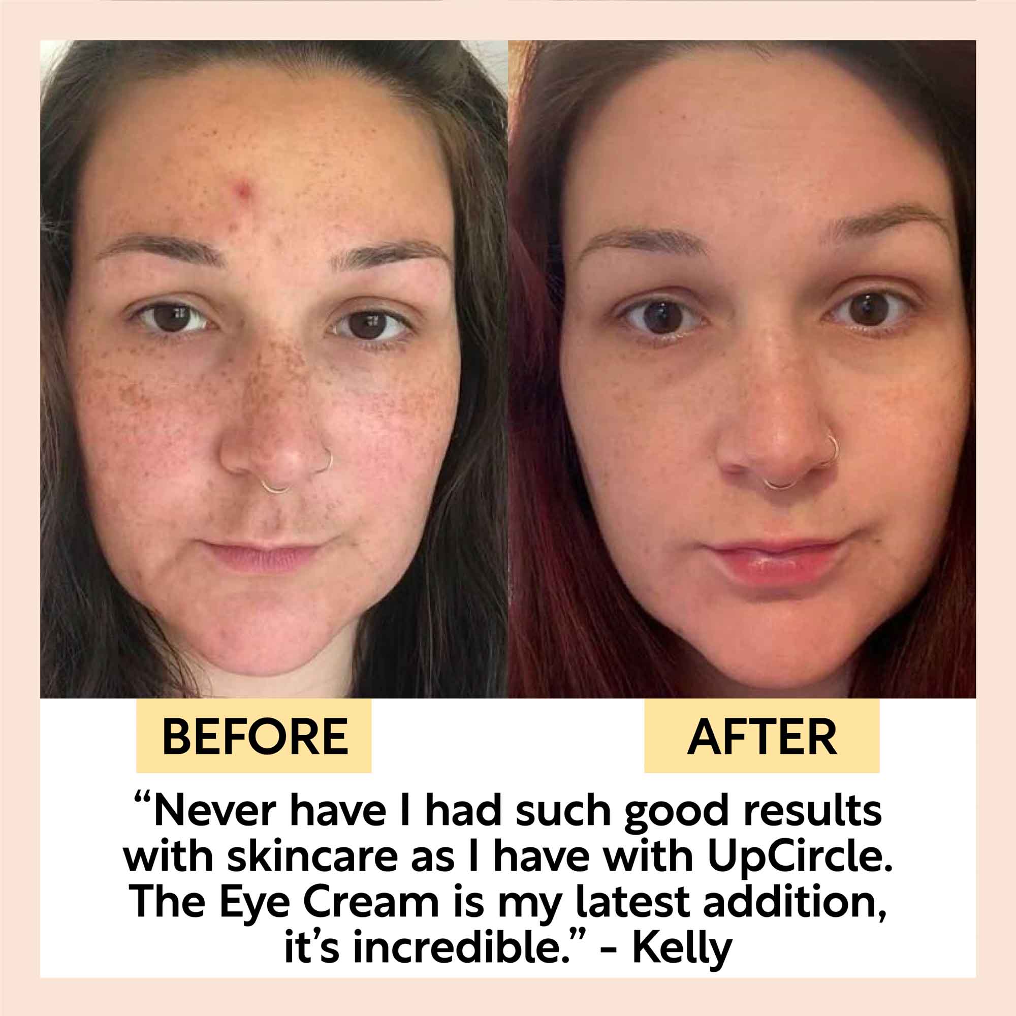 Eye Cream with Hyaluronic Acid &amp; Coffee